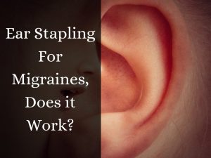 Ear stapling for migraines